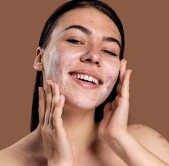  Ini 7 Cara Ampuh Menghilangkan Flek Hitam di Wajah yang Terbukti Efektif