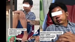 Remaja Pencuri Celana Dalam yang Dicabut Kukunya Oleh Ketua RT Dirawat Intensif