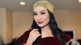 Iis Dahlia Bantah Lakukan Operasi Plastik di Korea Selatan