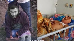 Tengahi Perselisihan 2 Pria, Kepala Dusun di Sumbar Malah Dibacok
