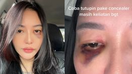 Bidi Jadi Korban KDRT Suami Usai Bongkar Perselingkuhan dengan LC