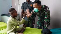 Kogabwilhan III Gelar Operasi Bibir Sumbing Gratis Anak-anak Papua