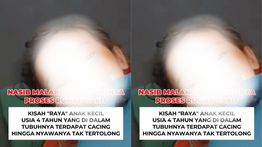 Bocah 4 Tahun di Sukabumi Tewas Setelah Tubuhnya Dipenuhi Cacing