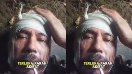 Eks Marinir TNI AL Satria Arta Kumbara Terluka Parah Usai Terkena Drone Kamikaze Ukraina
