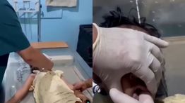 Detik-detik Tragis Bocah Tewas Usai Tersedak Rambutan