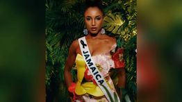 Miss Jamaica Alami Pendarahan Akibat Jatuh dari Panggung Kompetisi Miss Universe