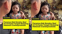 Heboh Beredar Video Bayi Cantik Didiagnosis Derita Craniosynostosis