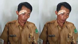 Viral Video Guru Dipukul Murid SMP di Luwu Utara hingga Alami Luka Robek