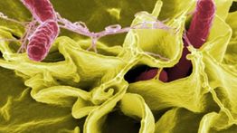 AS Tarik Suplemen Moringa Rosabella Diduga Terkait Wabah Salmonella