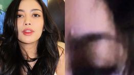 Rachel Vennya Diduga Kena Jotos Okin hingga Kelopak Mata Lebam