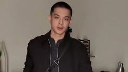 Rey Mbayang Ungkap Idap Autoimun Psoriasis