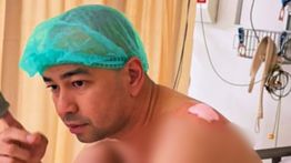 Raffi Ahmad Kena Kista di Bahu hingga Jalani Operasi
