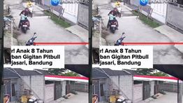 VIDEO: Tragis, Anak 8 Tahun Digigit Anjing Pitbull di Bandung