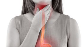 Sakit tenggorokan merupakan kondisi yang umum terjadi dan dapat disebabkan oleh berbagai faktor, seperti virus, bakteri, alergi, atau iritasi.