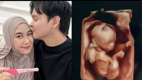 Anisa eks Cherrybelle umumkan kehamilan anak ketiganya.