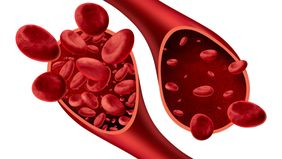 Kurang darah atau anemia adalah kondisi medis yang terjadi ketika tubuh kekurangan sel darah merah yang sehat atau hemoglobin. Hemoglobin berfungsi membawa oksigen ke seluruh tubuh, sehingga anemia dapat berdampak serius pada kesehatan.