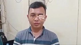 MSK (23), anak seorang Aparatur Sipil Negara (ASN) di Kementerian Pertahanan (Kemhan), akhirnya meminta maaf kepada para korban kecelakaan yang ia tabrak di Jalan Palmerah Barat II, Jakarta Barat, pada Senin, 20 Januari 2025 dini hari.