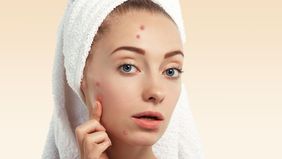 Jerawat dan bekasnya bisa menjadi masalah kulit yang bikin rasa percaya diri menurun. Simak berbagai cara menghilangkannya secara alami maupun medis, mulai dari perawatan rumahan, pilihan skincare yang tepat, hingga tips dari ahli kulit. 