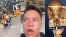 Beredar video rekaman CCTV dimana penumpang Ojol mengalami keretakan tulang hidung, pasca pengemudi ojol menabrak palang parkir.