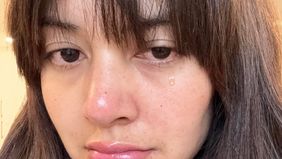 Aurelie Moeremans pamer kesedihan pasca mengetahui hasil MRI, di mana ia alami gegar otak karena kecelakaan mobil.