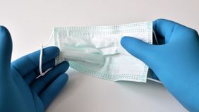 TBC adalah penyakit menular serius yang menyebar terutama melalui udara saat penderita batuk atau bersin. TBC tidak menular melalui sentuhan, makanan, atau hubungan seksual. 