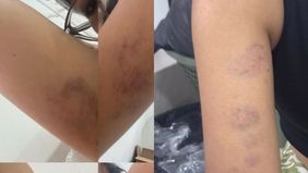 Seorang influencer asal Cianjur, Jawa Barat, bernama Risa Nur Arisa tengah menjadi pusat perhatian publik usai membagikan kisah memilukannya di media sosial.