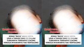 Kisah memilukan datang dari Desa Cianaga, Kecamatan Kabandungan, Sukabumi. Seorang bocah berusia 4 tahun bernama Raya harus kehilangan nyawa setelah tubuhnya dipenuhi cacing gelang. Dalam keterangan yang beredar, kondisi Raya sudah berlangsung sejak 