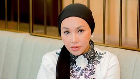 Dewi Gita lakukan operasi plastik di Korea Selatan, dan merogoh kocek sekitar Rp800 jutaan tanpa endorse.