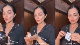 Wajah tirus Ashanty buat khawatir warganet, hingga dikaitkan dengan sakit autoimunnya.