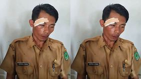 Sebuah video yang menampilkan seorang pria dengan wajah bersimbah darah mendadak viral di media sosial dan memicu keprihatinan publik. Rekaman tersebut ramai diperbincangkan karena disebut-sebut memperlihatkan seorang guru yang menjadi korban kekeras