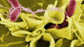 Food and Drug Administration (FDA) Amerika Serikat mengumumkan penarikan kembali produk suplemen bubuk moringa merek Moringa Rosabella setelah diduga berkaitan dengan wabah bakteri Salmonella.