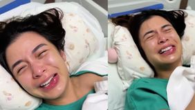 Chelsea Olivia alami pembengkakkan di bagian bibir, usai jalani 4 tindak operasi sekaligus.