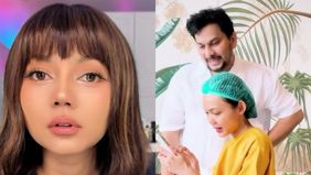 Penampilan terbaru Rina Nose usai lakukan operasi hidung di klinik dokter Tompi dengan hasil yang maksimal.