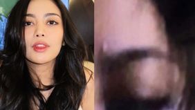 Rachel Vennya diduga kena jotos oleh mantan suaminya, hingga pamer kondisi kelopak mata yang penuh lebam.