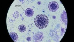 Direktur Jenderal World Health Organization Tedros Adhanom Ghebreyesus menegaskan bahwa kasus hantavirus yang terjadi di kapal pesiar MV Hondius tidak menimbulkan risiko besar bagi masyarakat di Kepulauan Canary.
