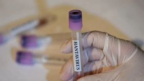Kementerian Kesehatan Venezuela mengonfirmasi tiga pasien meninggal dunia akibat infeksi hantavirus di Negara Bagian Anzoategui. Hingga saat ini, pemerintah Venezuela menyatakan belum menemukan kasus penularan virus tersebut antar manusia.