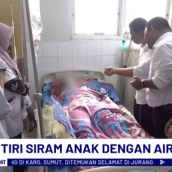 Sadis! Remaja 13 Tahun di Aceh Disiram Air Keras oleh Ayah Tiri Saat Tidur