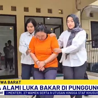 Keji! Bocah 1 Tahun Alami Luka Bakar Akibat Disiram Air Panas, Pelakunya Pengasuh Daycare