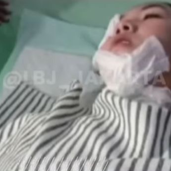 Detik-detik Wanita di Bekasi Jadi Korban Siram Air Keras, Langsung Buka Baju di Jalan