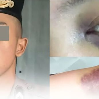 Viral Oknum Polisi di Cirebon Aniaya Wanita, Pelaku Kini Ditahan Polda Jawa Barat