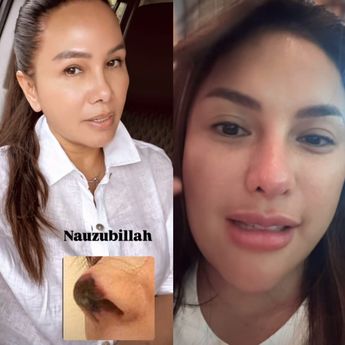 Fitri Salhuteru Sumpahi Hidung Nikita Mirzani Busuk