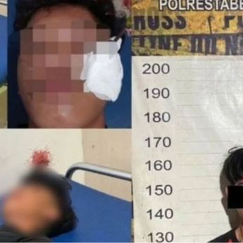 Pemuda di Makassar Kena Busur Panah pada Bagian Bawah Mata, Pelaku Nangis Diringkus Polisi