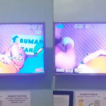 Viral! Balita Ditampar Tenaga Medis Saat Khitan di Cianjur
