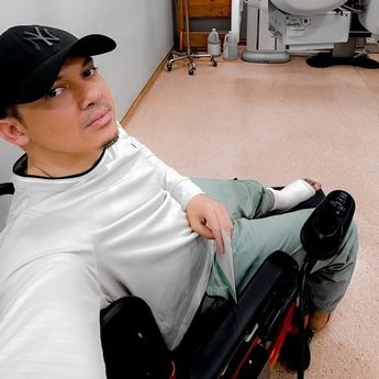 Jatuh dari Kuda, Kaki Irwansyah Alami Cedera hingga Patah