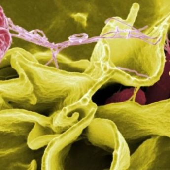 AS Tarik Suplemen Moringa Rosabella Diduga Terkait Wabah Salmonella