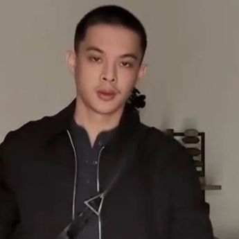 Rey Mbayang Ungkap Idap Autoimun Psoriasis