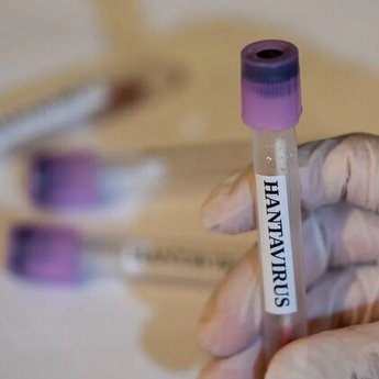 Belarus Ungkap 50 Kasus Hantavirus di Negaranya Setiap Tahun