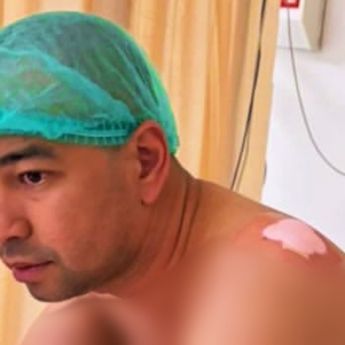 Raffi Ahmad Kena Kista di Bahu hingga Jalani Operasi