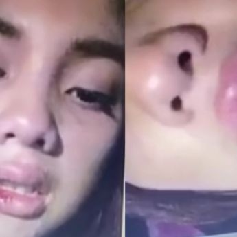 Raya Kitty Curhat Sempat Jadi Korban Kekerasan oleh Mantan Pacar