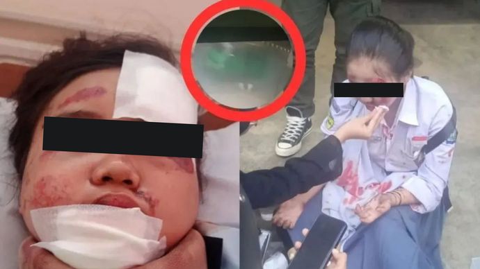 Sebuah insiden mengerikan menimpa seorang siswi SMA di Bandung terseret angkot yang ditumpanginya setelah sopir diduga tidak mau berhenti saat diminta.